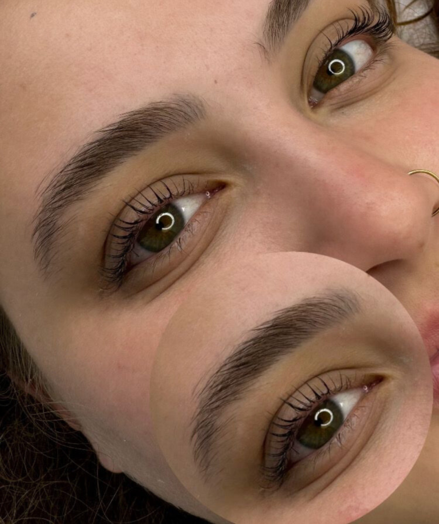 26
